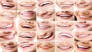 Dişlerinizi ne sıklıkla beyazlatmalısınız?