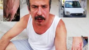 Kocası Suratına Yumruk Attı Karısı Elini Isırdı! 