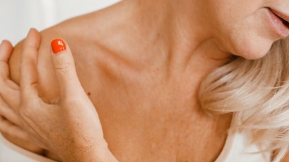 Cilt Kanserine Karşı Koruma Rehberi