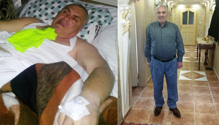AYAĞA KALKMASI İMKÂNSIZ DENİLEN FELÇLİ HASTA, DÖRT HAFTADA YÜRÜDÜ