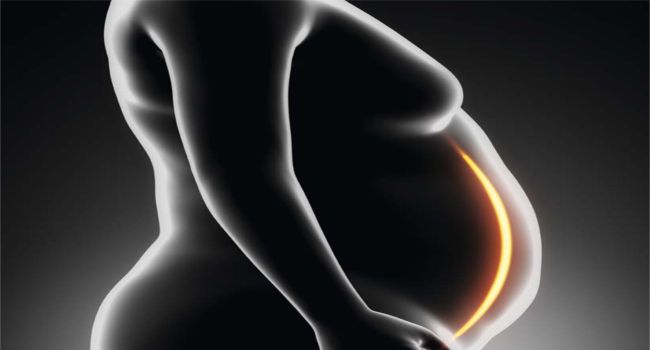 Kilo Verme Sonrası Oluşan Şekil Bozukluklarını Gidermesi Artık Daha Kolay