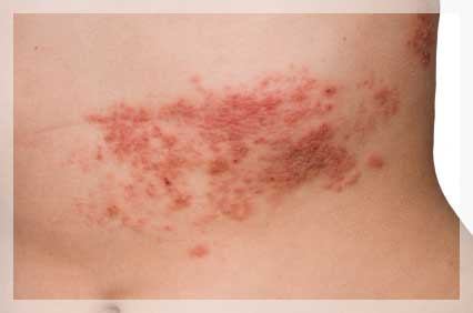 STRES VE ÜZÜNTÜ ZONAYA DAVETİYE ÇIKARIYOR