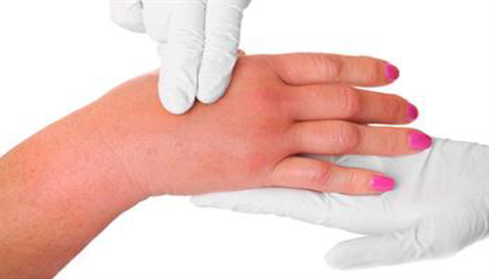 YAZ AYLARI ÖDEM ŞİKAYETLERİNİ ARTIRIYOR